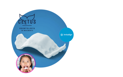 La revolución de la ortodoncia: Invisalign Palatal Expander